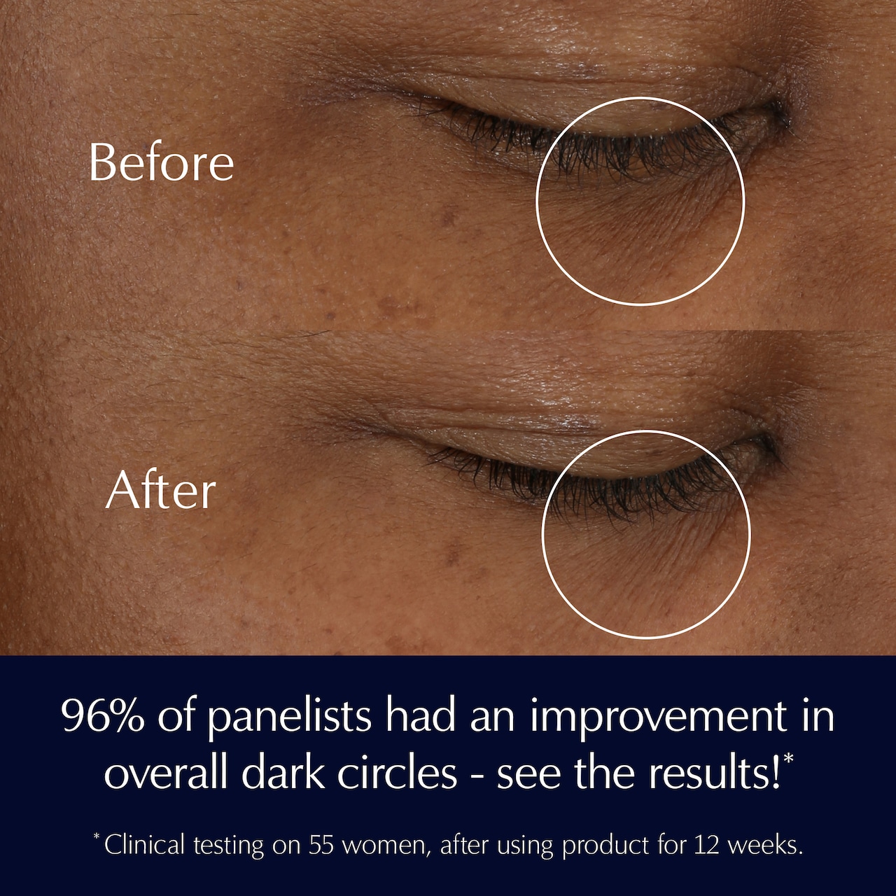 Advanced Night Repair Eye Cream Skincare Set
